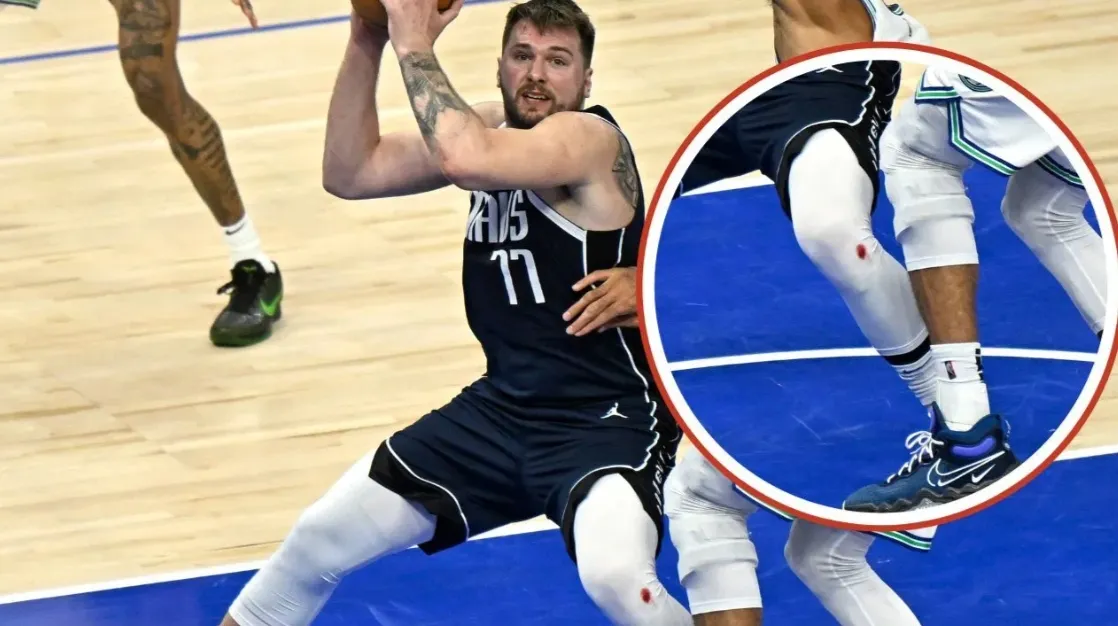 东契奇库里膝上血迹真相 反复地板擦伤致疤痕撕裂渗血